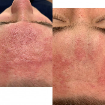 Христина Чорній, Тернополь Фото - 33