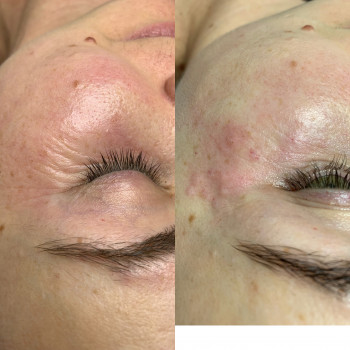 Христина Чорній, Тернополь Фото - 57