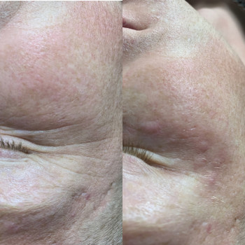 Христина Чорній, Тернополь Фото - 61