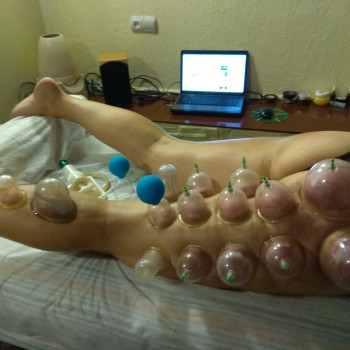 Антицелюлітні програми корекції фігури
                    Массажный салон Студія Масажного Мистецтва Ровно