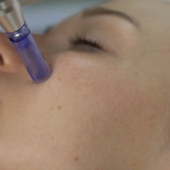 Программа Анти-ейдж InLab Medical лицо шея
                    Косметолог-эстетист Лариса Харьков