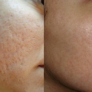 Ирина Лапань, Киев Фото - 11