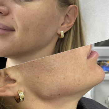 Ирина Лапань, Киев Фото - 12