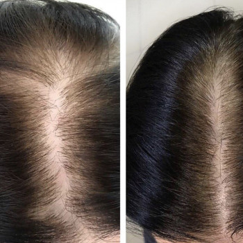 Ирина Лапань, Киев Фото - 15