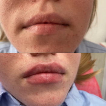 Яна Саманчук, Киев Фото - 28