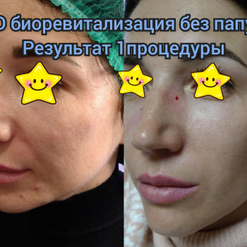 Людмила Коренко, Одесса Фото - 21