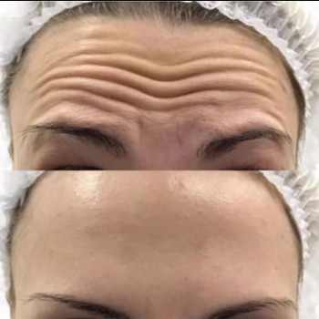 Виктория Игнатенко, Одеса Фото - 5