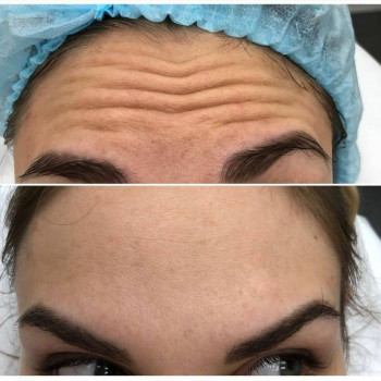 Виктория Игнатенко, Одеса Фото - 6