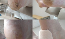 Установление разгрузки Косметолог-ін'єкціоніст Елена Харків