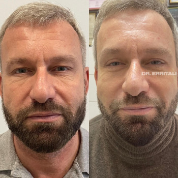 Абдель Эрритали, Харків Фото - 72