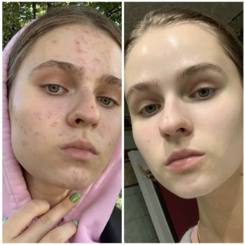 Правильно подобранный домашний уход