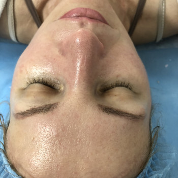 Сияющая кожа!☺️