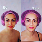Авторский 3 D лифтинговый массаж Косметолог Наталья Олеговна Харьков