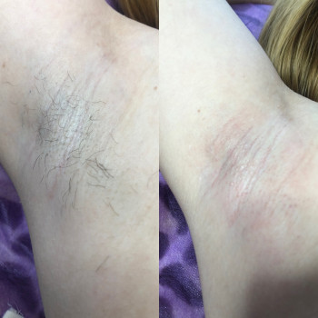 Катерина Дубровська, Луцьк Фото - 5