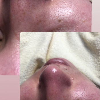 Катерина Дубровська, Луцьк Фото - 8