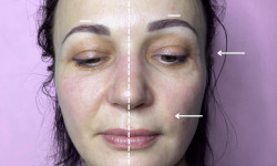 Моделюючий масаж обличчя Салон красоты Sweet Skin Киев