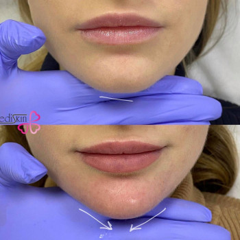 Mediskin, Мукачево Фото - 5