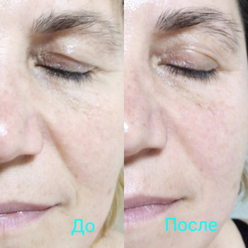 Міофасціальний масаж

1 сеанс