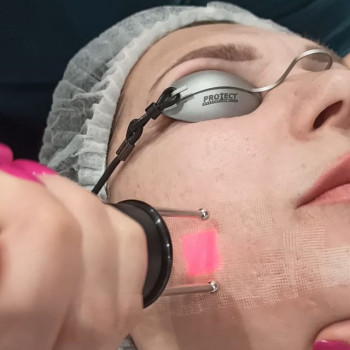 Forever Young, Ковель Фото - 5