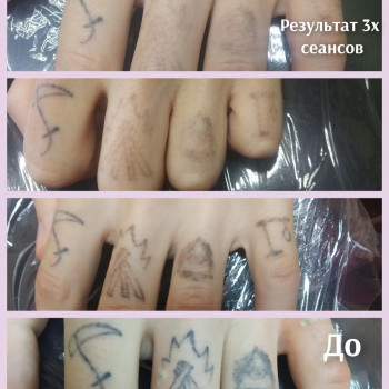 Удаление тату и татуажа
                    Мастер перманентного макияжа Ольга Николаев