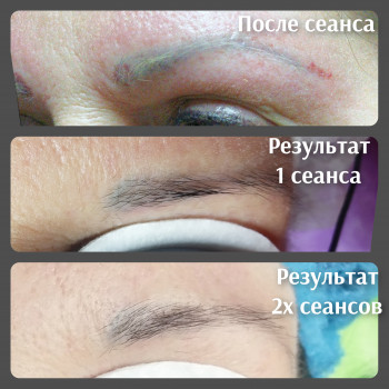 Удаление тату и татуажа
                    Мастер перманентного макияжа Ольга Николаев