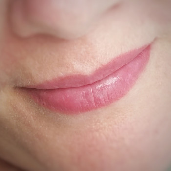 Зажившие перед коррекцией