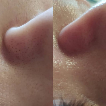 Елена Овчарук, Ірпінь Фото - 5