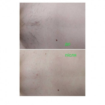 Елена Овчарук, Ірпінь Фото - 6