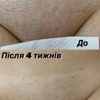 Татьяна Погребняк, Обухов Фото - 5