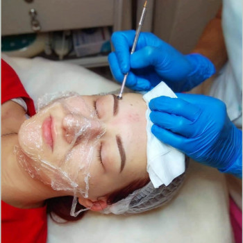 Мануальная чистка лица, фото - косметолог ВикторияВікторія Моцная