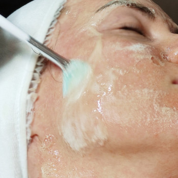 Карбоксітерапія, фото - косметолог ВикторияВікторія Моцная