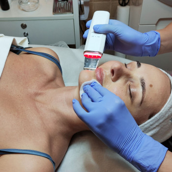 Ультрозвуковая чистка лица, фото - косметолог ВикторияВікторія Моцная