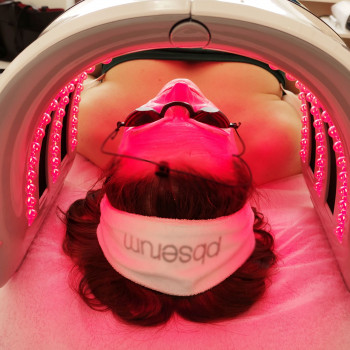 Стимулирующая LED – терапия после инъекций, фото - косметолог ВикторияВікторія Моцная