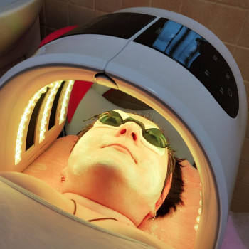 Себоррегулирующая LED - терапия, фото - косметолог ВикторияВікторія Моцная