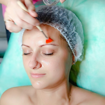 Пилинг, фото - косметолог ВикторияВікторія Моцная