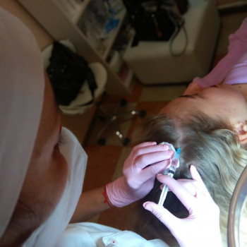 Мезотерапия кожи головы, фото - косметолог ВикторияВікторія Моцная