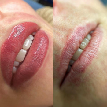 Татуаж губ (Перманент губ)
                    Майстер перманентного макіяжу Олександра Тернопіль