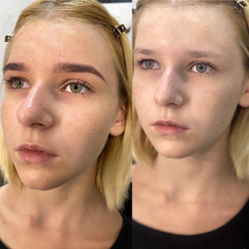 Робота з перещіпаними бровами
Відрощу вам брови
Тривалість