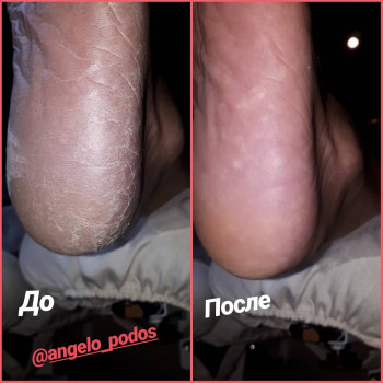 Мария Ангельчук, Одеса Фото - 6