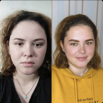 До и После
Брови в технике Air EyeBrows сразу после процедур