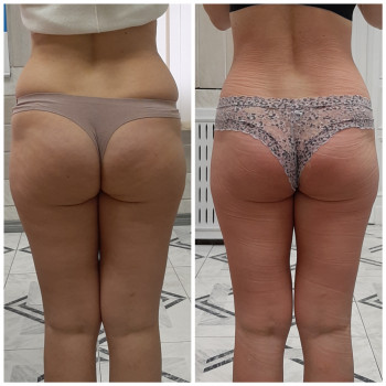 Юлия Figura, Одесса Фото - 5