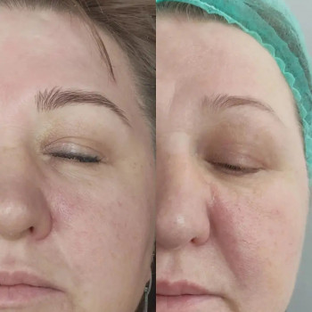 Янина Калинская, Черноморск Фото - 8