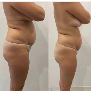 Зинаида Шуллер, Ужгород Фото - 18