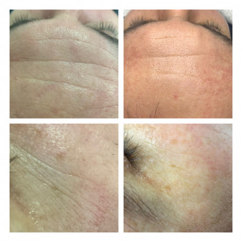 Зинаида Шуллер, Ужгород Фото - 21