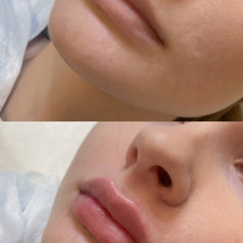 Дана Гуртова, Луцк Фото - 77