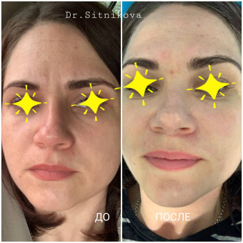 Ирина Ситникова, Киев Фото - 36