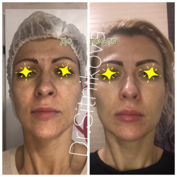 Ирина Ситникова, Киев Фото - 39