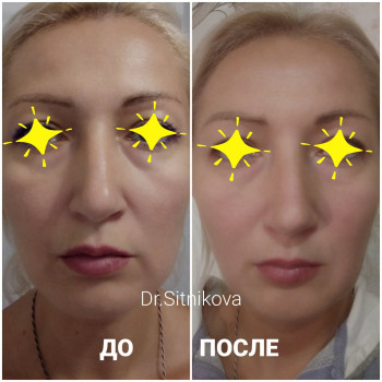 Ирина Ситникова, Киев Фото - 42