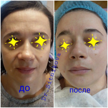 Ирина Ситникова, Киев Фото - 44