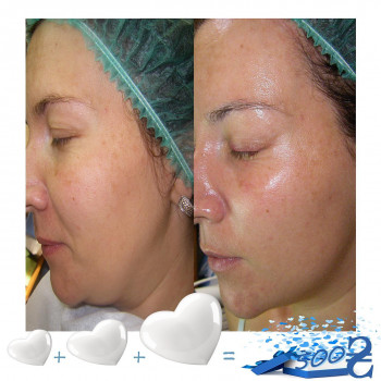 Людмила Чайка, Київ Фото - 10